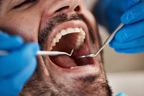 Best Emergency TMJ Treatment in Buffalo Center, IA